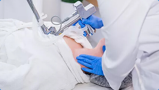 used medical laser equipment