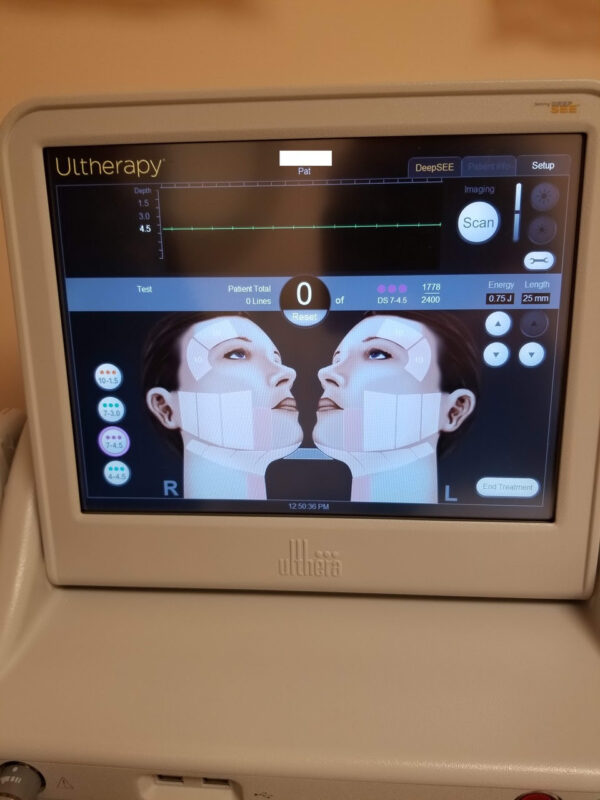 2017 ULTHERA ULTHERAPY ULTRASOUND SKIN TIGHTENING