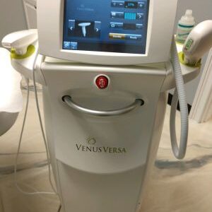 2017 Venus Versa
