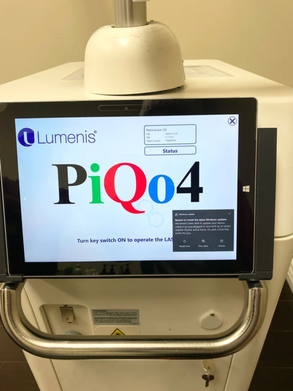 Lumenis PiQo4 Laser Tattoo