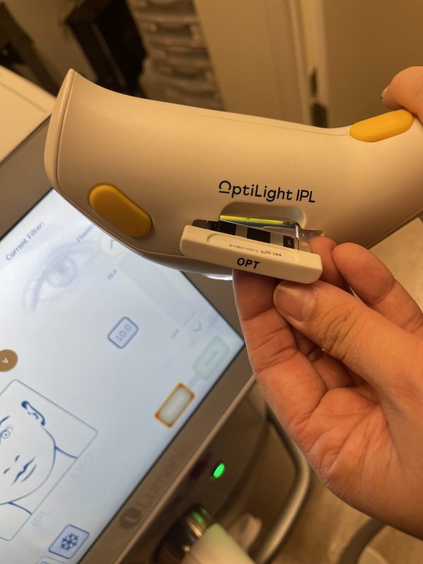 2021 Lumenis OptiLIGHT