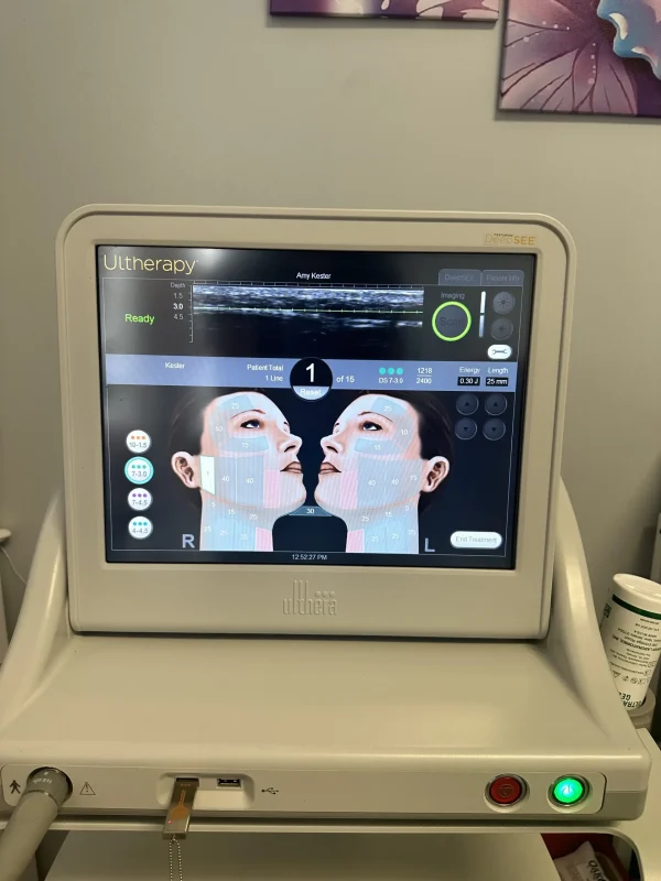 2021 Ulthera Ultherapy Ultrasound