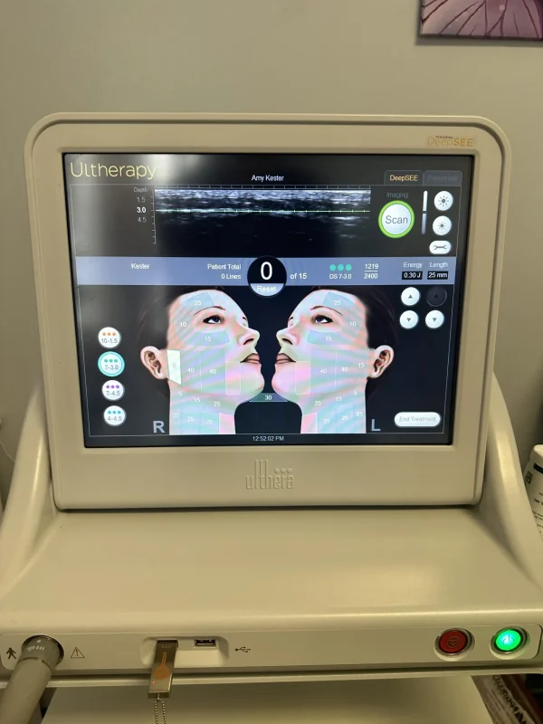 2021 Ulthera Ultherapy Ultrasound Skin