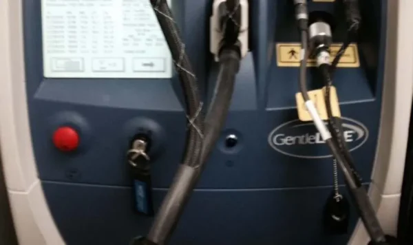 2007 Candela Gentlelase Mini